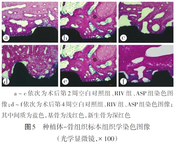 【文章薦讀】利伐沙班對種植體早期骨結合影響研究