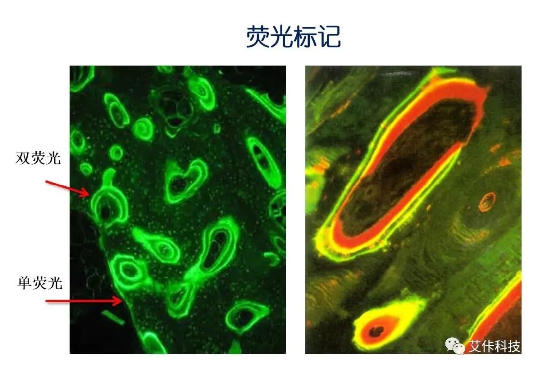 【技術問答 十二】骨形態計量分析-骨折模型篇